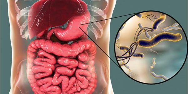 Helicobacter Pylori: A Bactéria Silenciosa Que Pode Causar Úlceras e Gastrite